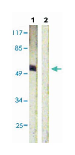 ETS1 (phospho T38), Rabbit anti-Human, Mouse, Rat, Polyclonal Antibody,