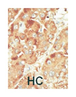 NLK, Rabbit, Polyclonal Antibody, Abnova 400 &mu;L | Buy Online | Abnova Corporation | Fisher Scientific
