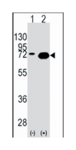 HSPA1A, Rabbit, Polyclonal Antibody, Abnova 400&mu;L; Unlabeled:Antibodies,