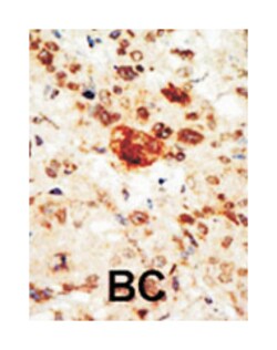 EPHA1 Rabbit anti-Human, Polyclonal Antibody, Abnova 400 &mu;L | Buy Online | Abnova Corporation | Fisher Scientific