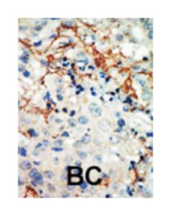 EPHA3 Rabbit anti-Human, Polyclonal Antibody, Abnova 400 &mu;L | Buy Online | Abnova Corporation | Fisher Scientific