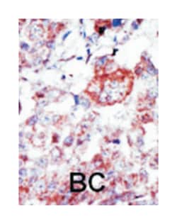 ILK Rabbit anti-Human, Polyclonal Antibody, Abnova 400 &mu;L | Buy Online | Abnova Corporation | Fisher Scientific