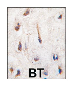 ERAS Rabbit anti-Human, Polyclonal Antibody, Abnova 400 &mu;L | Buy Online | Abnova Corporation | Fisher Scientific