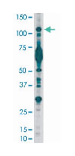 PIK3CB, Rabbit, Polyclonal Antibody, Abnova 400 &mu;L | Buy Online | Abnova Corporation | Fisher Scientific