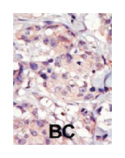 PDGFRA Rabbit anti-Human, Mouse, Polyclonal Antibody, Abnova 400 &mu;L | Buy Online | Abnova Corporation | Fisher Scientific