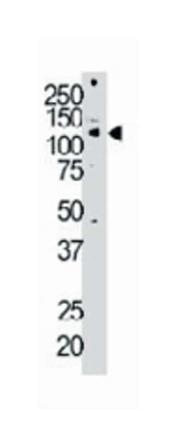 RET Rabbit anti-Human, Polyclonal Antibody, Abnova 400 &mu;L | Buy Online | Abnova Corporation | Fisher Scientific