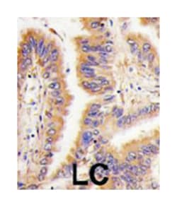 TGM2 Rabbit anti-Human, Polyclonal Antibody, Abnova 400 &mu;L | Buy Online | Abnova Corporation | Fisher Scientific