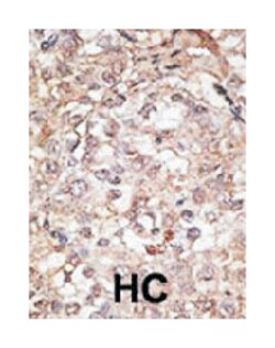 TLR1 Rabbit anti-Mouse, Polyclonal Antibody, Abnova 400&mu;L; Unlabeled:Antibodies,