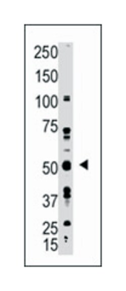 GDF10, Rabbit, Polyclonal Antibody, Abnova 400 &mu;L | Buy Online | Abnova | Fisher Scientific