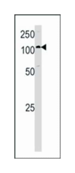 HK1 Rabbit anti-Human, Polyclonal Antibody, Abnova 400 &mu;L | Buy Online | Abnova Corporation | Fisher Scientific