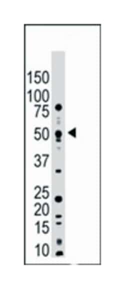 USP14, Rabbit, Polyclonal Antibody, Abnova 400 &mu;L | Buy Online | Abnova Corporation | Fisher Scientific