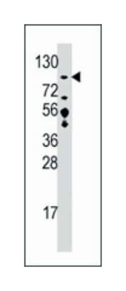 USP33 Rabbit anti-Human, Polyclonal Antibody, Abnova 400&mu;L; Unlabeled:Antikörper