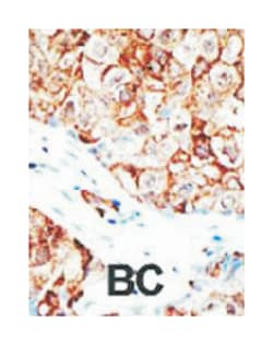 UBQLN1 Rabbit anti-Human, Mouse, Polyclonal Antibody, Abnova 400&mu;L;