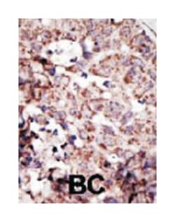 AGER Rabbit anti-Human, Polyclonal Antibody, Abnova 400 &mu;L | Buy Online | Abnova Corporation | Fisher Scientific