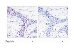 ATF2 Rabbit anti-Human, Mouse, Rat, Polyclonal Antibody, Abnova 100 &mu;g | Buy Online | Abnova | Fisher Scientific
