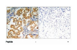 PRKCZ Rabbit anti-Human, Mouse, Rat, Polyclonal Antibody, Abnova 100 &mu;g | Buy Online | Abnova | Fisher Scientific