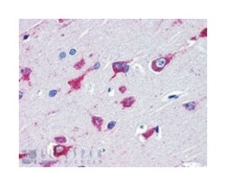 ALS2, Goat, Polyclonal Antibody, Abnova 100 &mu;g | Buy Online | Abnova Corporation | Fisher Scientific