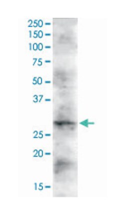 DKK2, Goat, Polyclonal Antibody, Abnova 100 &mu;g | Buy Online | Abnova Corporation | Fisher Scientific