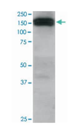 DCTN1, Goat, Polyclonal Antibody, Abnova 100 &mu;g | Buy Online | Abnova Corporation | Fisher Scientific