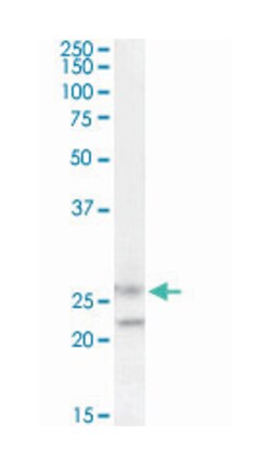 FBXO44, Goat, Polyclonal Antibody, Abnova 100&mu;g; Unlabeled:Antibodies,