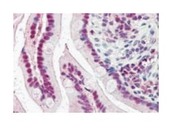 KPNA4, Goat, Polyclonal Antibody, Abnova 100 &mu;g | Buy Online | Abnova Corporation | Fisher Scientific