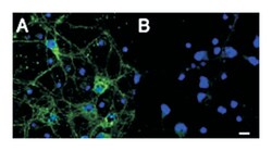 IFT74, Goat, Polyclonal Antibody, Abnova 100&mu;g; Unlabeled:Antibodies,