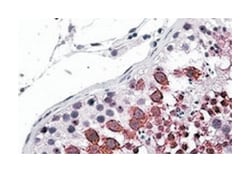 GALR3, Goat, Polyclonal Antibody, Abnova 100 &mu;g | Buy Online | Abnova Corporation | Fisher Scientific