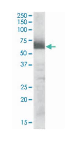 CYP17A1, Goat, Polyclonal Antibody, Abnova 100 &mu;g | Buy Online | Abnova Corporation | Fisher Scientific