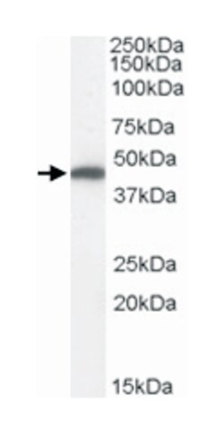 FH, Goat, Polyclonal Antibody, Abnova 100 &mu;g | Buy Online | Abnova Corporation | Fisher Scientific