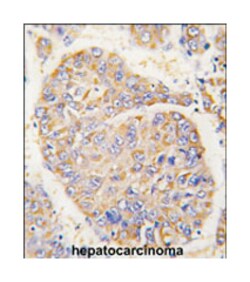 PEBP1 Rabbit anti-Human, Mouse, Polyclonal Antibody, Abnova 400 &mu;L | Buy Online | Abnova Corporation | Fisher Scientific