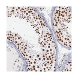 SMEK1, Rabbit, Polyclonal Antibody, Abnova 100&mu;L; Unlabeled:Antibodies,