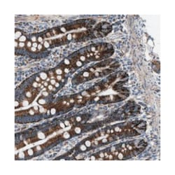 VPS13A Rabbit anti-Human, Polyclonal Antibody, Abnova 100&mu;L; Unlabeled:Antibodies,