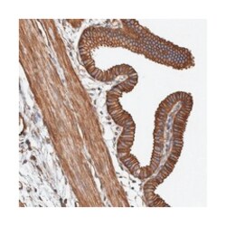 PKD1L1 Rabbit anti-Human, Polyclonal Antibody, Abnova 100 &mu;L | Buy Online | Abnova Corporation | Fisher Scientific