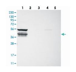 RPH3AL, Rabbit, Polyclonal Antibody, Abnova 100&mu;L; Unlabeled:Antibodies,