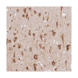 AADACL1, Rabbit, Polyclonal Antibody, Abnova 100 &mu;L | Buy Online | Abnova Corporation | Fisher Scientific