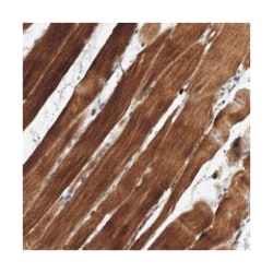 SOBP, Rabbit, Polyclonal Antibody, Abnova 100 &mu;L | Buy Online | Abnova Corporation | Fisher Scientific
