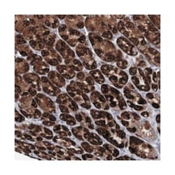 CES4A, Rabbit, Polyclonal Antibody, Abnova 100&mu;L; Unlabeled:Antibodies,