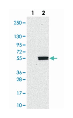 KTELC1, Rabbit, Polyclonal Antibody, Abnova 100&mu;L; Unlabeled:Antibodies,