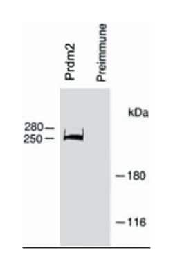 PRDM2, Rabbit, Polyclonal Antibody, Abnova 400 &mu;L | Buy Online | Abnova Corporation | Fisher Scientific