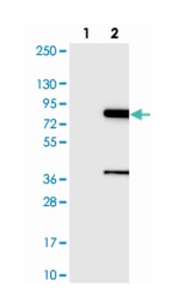 KATNB1 Rabbit anti-Human, Polyclonal Antibody, Abnova 100 &mu;L | Buy Online | Abnova Corporation | Fisher Scientific