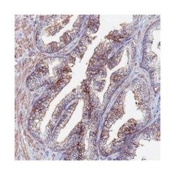 C6, Rabbit, Polyclonal Antibody, Abnova 100 &mu;L | Buy Online | Abnova Corporation | Fisher Scientific