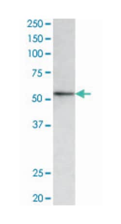 HDAC1, Goat, Polyclonal Antibody, Abnova 100 &mu;g | Buy Online | Abnova Corporation | Fisher Scientific