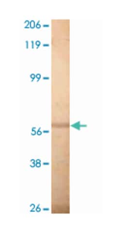 PDE1A7, Rabbit, Polyclonal Antibody, Abnova 100&mu;g; Unlabeled:Antibodies,