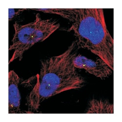 ZNF285, Rabbit, Polyclonal Antibody, Abnova 100 &mu;L | Buy Online | Abnova Corporation | Fisher Scientific