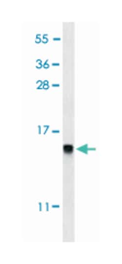 DEFB112, Rabbit, Polyclonal Antibody, Abnova 400 &mu;L | Buy Online | Abnova Corporation | Fisher Scientific