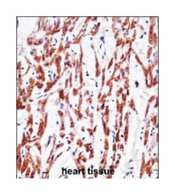 TMEM85, Rabbit, Polyclonal Antibody, Abnova 400 &mu;L | Buy Online | Abnova Corporation | Fisher Scientific
