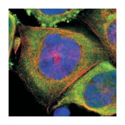 PSMD10 Rabbit anti-Human, Mouse, Rat, Polyclonal Antibody, Abnova 100&mu;L;