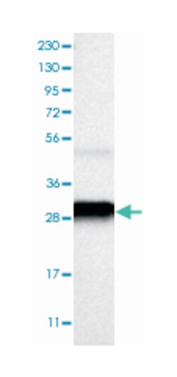 CTSD Rabbit anti-Human, Polyclonal Antibody, Abnova 100 &mu;L | Buy Online | Abnova Corporation | Fisher Scientific