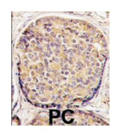 PIK3CB, Rabbit, Polyclonal Antibody, Abnova 400 &mu;L | Buy Online | Abnova Corporation | Fisher Scientific