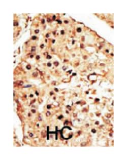 TRPM7 Rabbit anti-Human, Polyclonal Antibody, Abnova 400 &mu;L | Buy Online | Abnova Corporation | Fisher Scientific